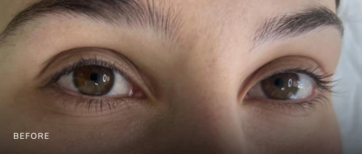 Facial Transformation — Case 2 — Before and After