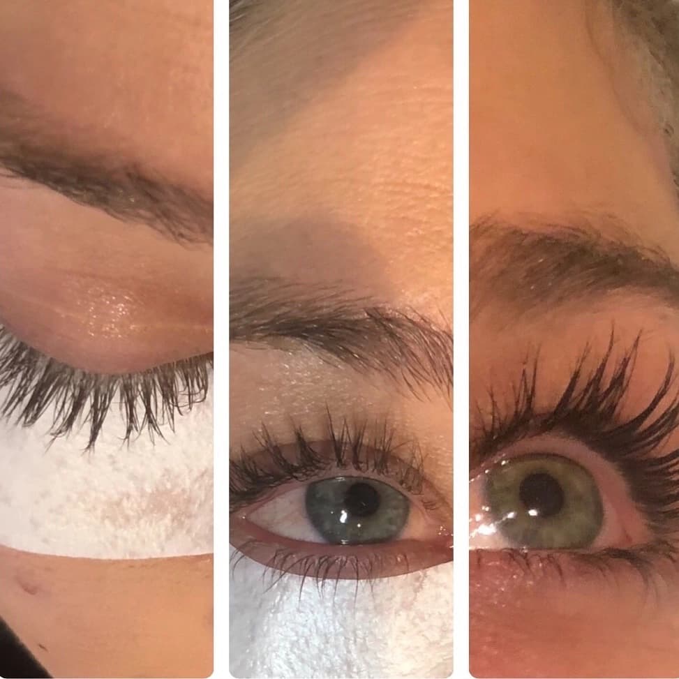 Lash Lift & Tint — Case 2 — Before and After